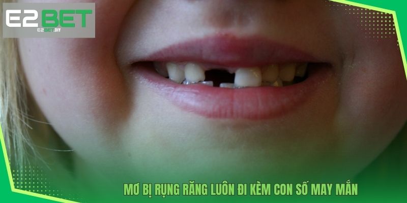 Mơ bị rụng răng luôn đi kèm con số may mắn 